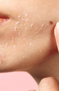Basic Home Skincare Routine for Dry Skin: Step-by-Step Guide